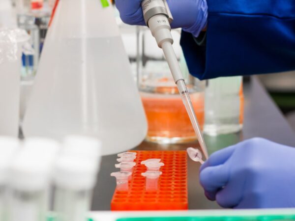 Should You Test Your Gut Microbiome? Understanding the Benefits and Limitations